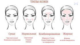 Как определить тип поддержки в Зара Хоум